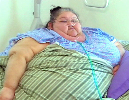 http://a.abcnews.com/images/Health/abc_obese_woman_080924_ssh.jpg