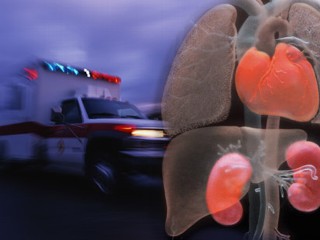 organs