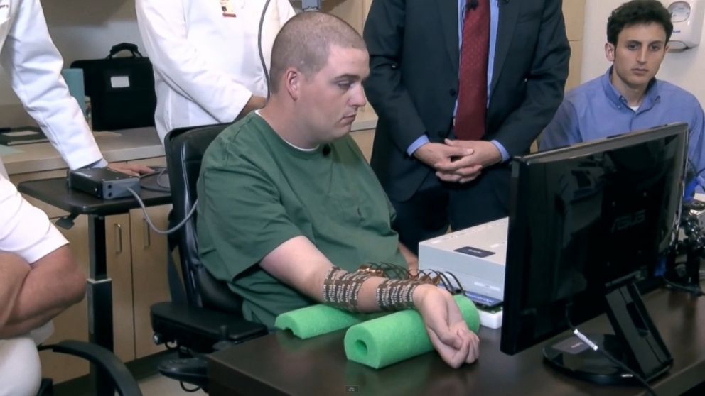 VIDEO: Ian Burkhart, 23, is the first quadriplegic patient to use Neurobridge technology.