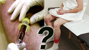 Should Men Get Prostate Cancer Screening?