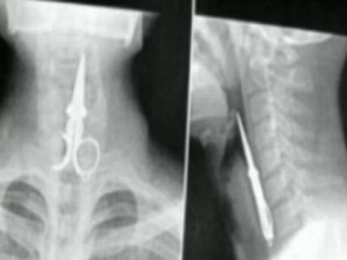 X-Ray Oddities