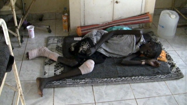 PHOTO: Eleven-year-old Kakayo recovers from wounds suffered during a recent round of violent tribal clashes in South Sudan