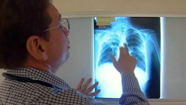 PHOTO: Two hospitals in Sacramento and Solano County, California, have reached out to parents of 25 babies who many have been exposed to tuberculosis in the hospitals neonatal intensive care units.
