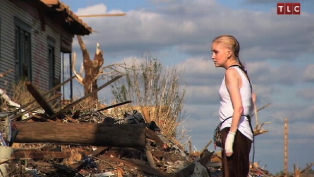 VIDEO: Sam Hall has a dangerous skin condition and risks her life.