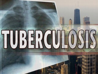PHOTO A Northwestern University doctor-in-training potentially exposed hundreds of patients to TB