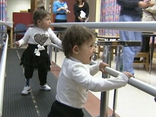 Twins from Gaza Get Chance to Walk Thanks to Prosthetics