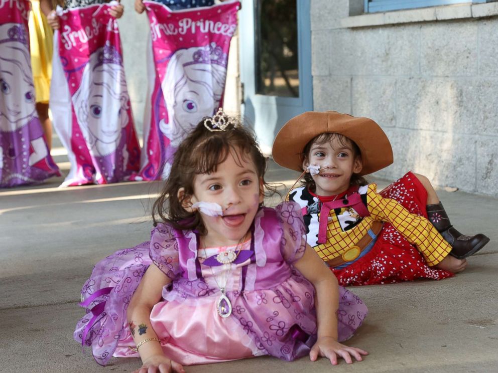 Formerly conjoined twins Eva and Erika Sandoval are seen here celebrating their third birthday.