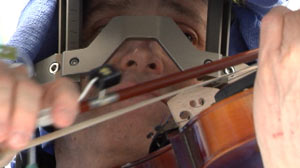 VIOLIN BRAIN SURGERY