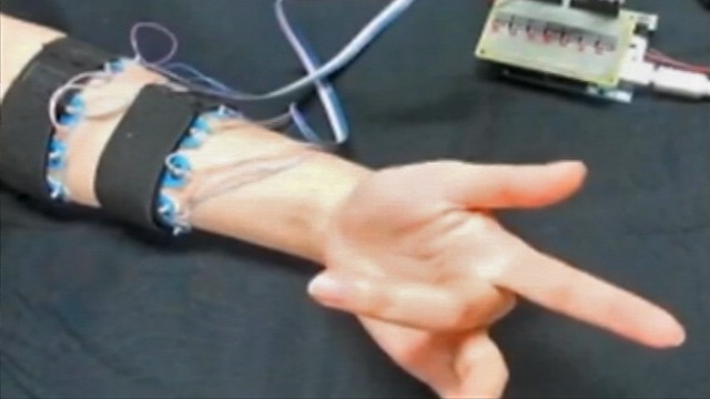 Possessed Hand Nerve Stimulating Device Makes Fingers Move Abc News