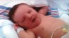 VIDEO: A newborn in Alabama has been born with paralyzed vocal chords.