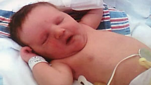 Photo: Baby Who Cannot Cry