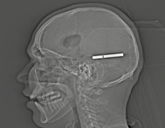 X-Ray Oddities