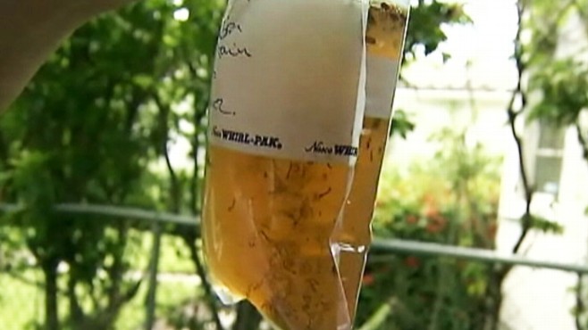 Video: Miami woman contracts dengue fever after mosquito bite.