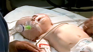 Photo: Doctors Rebuild Babys Skull: Extensive Surgery Helps Infant With Rare Genetic Syndrome