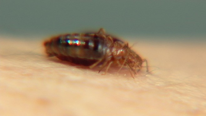 Study: Bedbugs Can Carry MRSA Video - ABC News