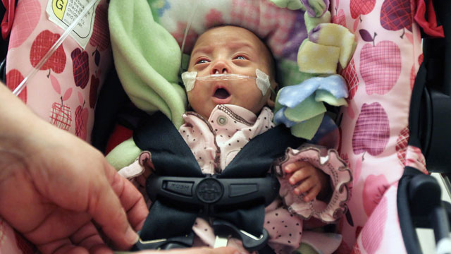 PHOTO: "Miracle Baby" sent home from hospital