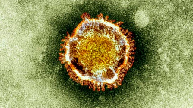PHOTO: An electron microscope image of a coronavirus, part of a family of viruses that cause ailments including the common cold and SARS.