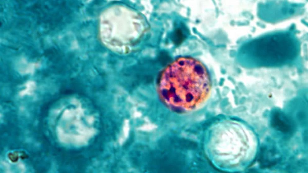 PHOTO: Stool sample with Cyclospora