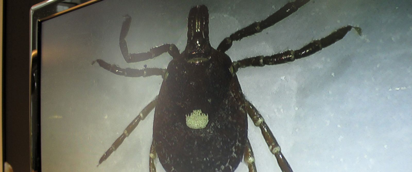 PHOTO: A lone star tick is displayed on a monitor in a lab at the North Carolina Museum of Natural Sciences, in Raleigh, N.C., July 31, 2014.