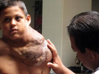 Photos: Boy Suffers From Massive Tumor