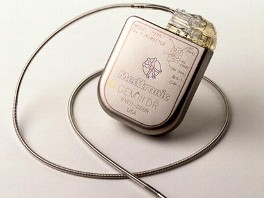 An ICD, which is designed to shock the heart back into rhythm