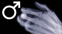 claw hand
