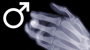 claw hand