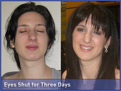 eyes_shut_081202_main.jpg