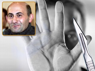 Paris hospital authority says surgeons perform partial face and hand transplant