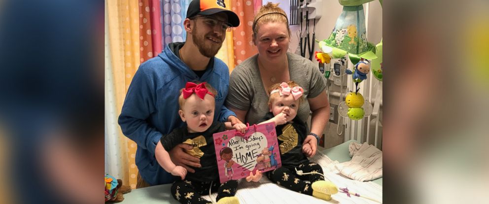 PHOTO: A pair of formerly conjoined twins are being discharged from the hospital just in time for Thanksgiving after a successful surgery to separate them.