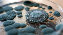PHOTO: An Agar plate plate of mold is seen in this undated file photo.
