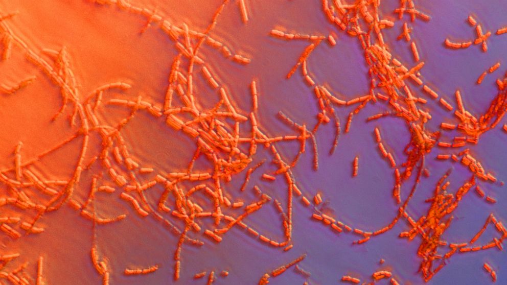 PHOTO: Anthrax is a disease caused by rod-shaped bacteria known as Bacillus anthracis.