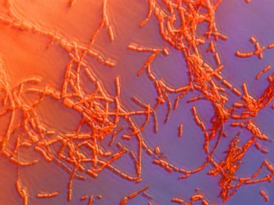 75 Potentially Exposed to Anthrax in CDC Breach