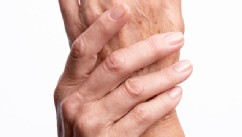 PHOTO: Despite the common belief that arthritis only affects the elderly, nearly two-thirds of people with arthritis are younger than 65.
