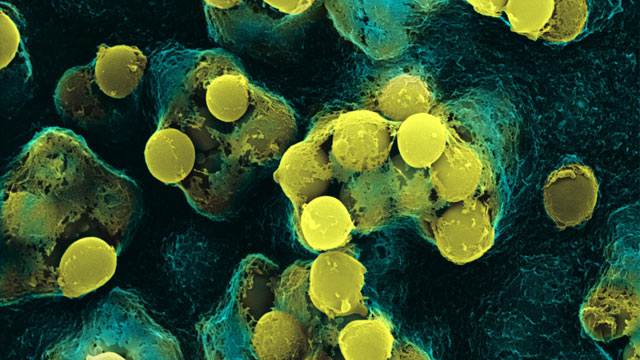 PHOTO: "A new study finds that a little bacteria is actually a good thing for the immune system."