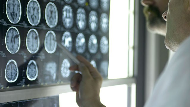 PHOTO: Mark Templin was told he had a terminal brain tumor.