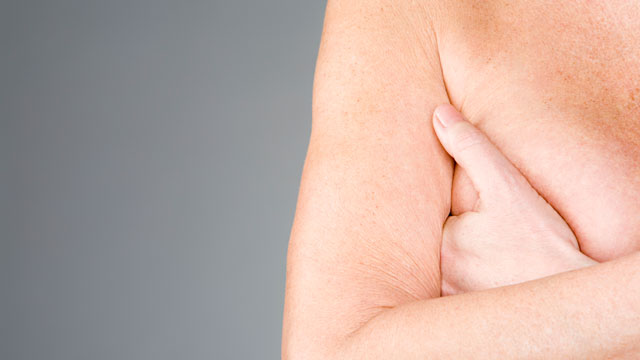 PHOTO: A new vaccine may be able to keep an aggressive type of breast cancer from returning.