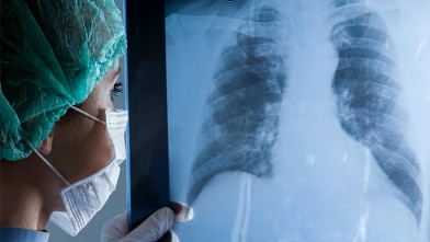 PHOTO: Chest x-ray