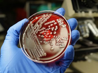 Which Scary Superbugs Pose the Biggest Threats at Home?