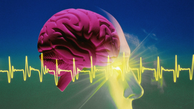 PHOTO: EEG and human brain graphic