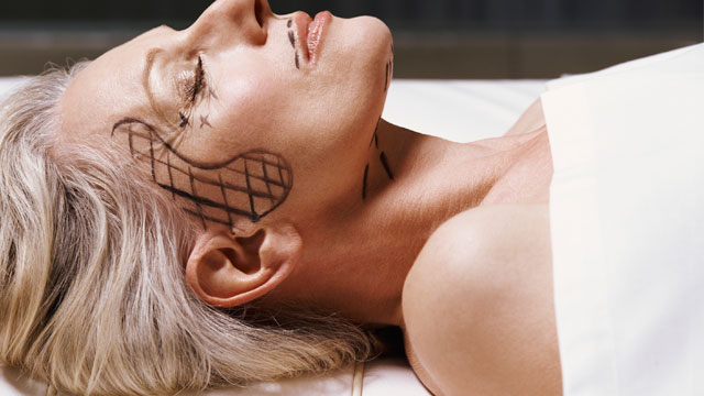 PHOTO: A new study reveals patients looked an average of about 9 years younger after surgery.