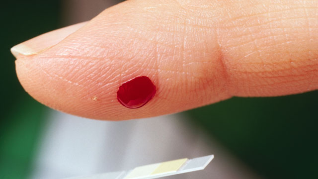 PHOTO: A finger is pricked in this file photo.