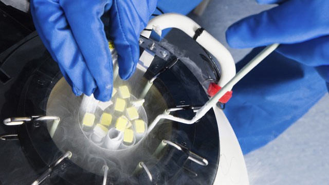 PHOTO: Doctors hands removing embryo samples from cryogenic storage, fertilized embryos are stored in liquid nitrogen filled tanks to keep them as new if patients require them at a later date.