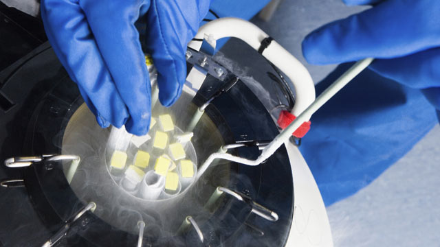 PHOTO: Doctors hands removing embryo samples from cryogenic storage, fertilized embryos are stored in liquid nitrogen filled tanks to keep them as new if patients require them at a later date.