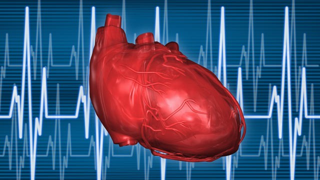 PHOTO: A type of cholesterol many have never heard of, may be a leading cause of heart disease.