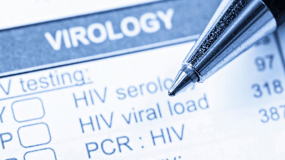 PHOTO: State law requires that any time someone tests positive for Chlamydia or gonorrhea, it must be reported to the health department, and the counties get daily reports.