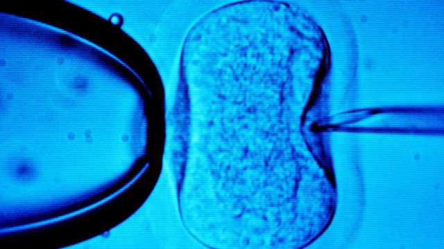 PHOTO: The medical procedure, in vitro fertilization, is seen under the microscope in this undated photograph.