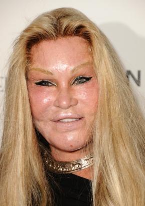 Extreme Plastic Surgery