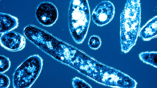PHOTO: Legionella pneumophila, the bacteria responsible for Legionnaires disease, is shown.