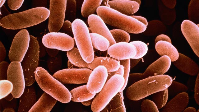 PHOTO: Listeria monocytogenes bacteria
